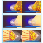 Ozone Female breast /Chest/Mamarian Cup - Image 4