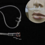 5pcs/Lot PVC Nasal Cannula for Sinus Insufflation - Image 4