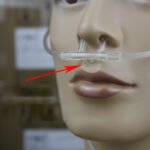 5pcs/Lot PVC Nasal Cannula for Sinus Insufflation - Image 5