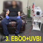 UVBI Ultraviolet Blood Irradiation Machine For Blood Treatment - Image 8